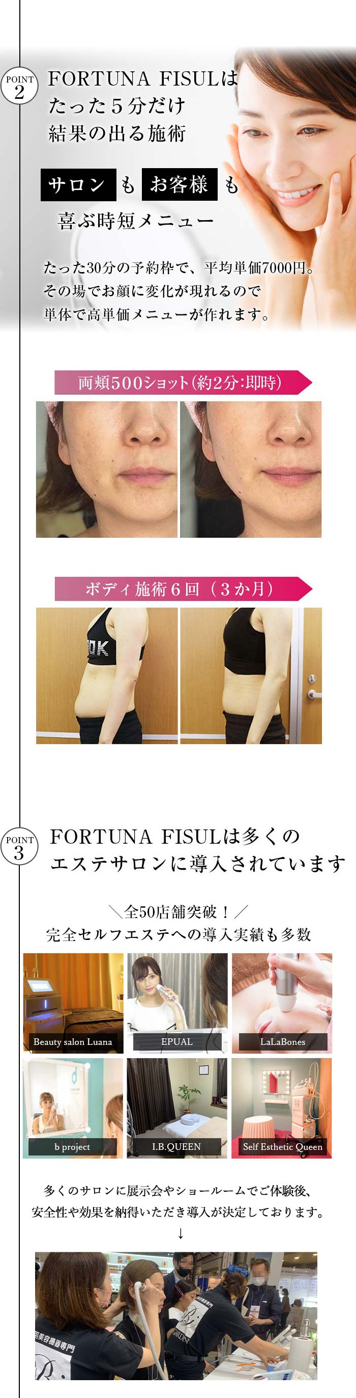 楽天市場】【FORTUNA FISUL】 業務用エステマシン 蓄熱式超音波 1.5mm