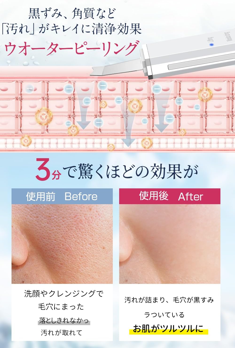 楽天市場】ウォーターピーリング 美顔器 超音波ピーリング 毛穴