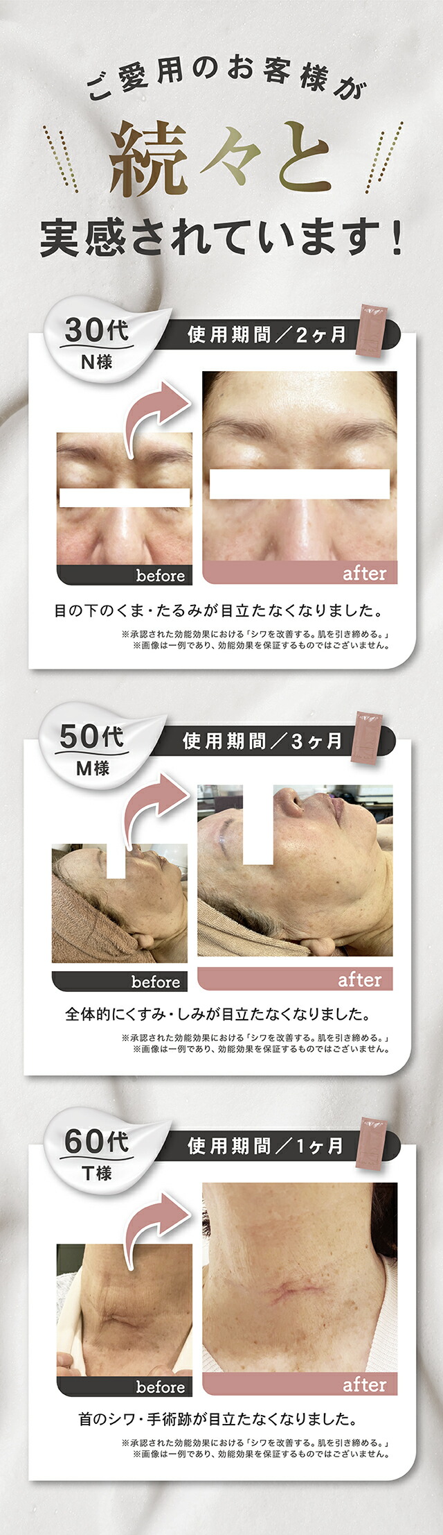 楽天市場】Moi Belle モ ベレ しわ改善 美白※ クリーム 120g【医薬部外