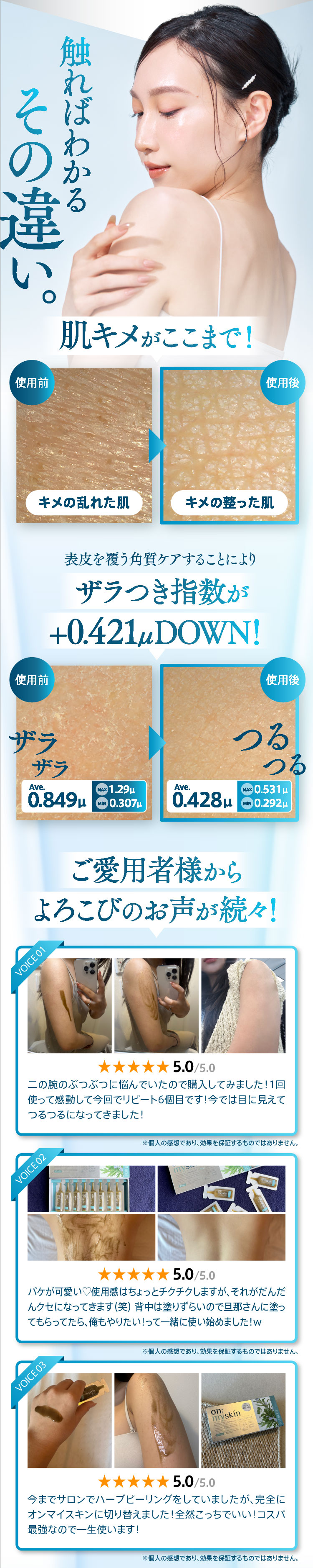 楽天市場】公式 on:myskin body用 │ 自宅でハーブピーリング 美容施術