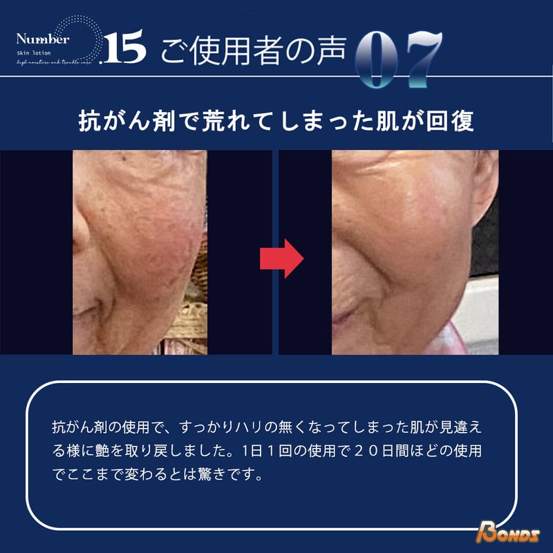 NO.15(ナンバーフィフティーン)モイスチャースキンローション | ケミ