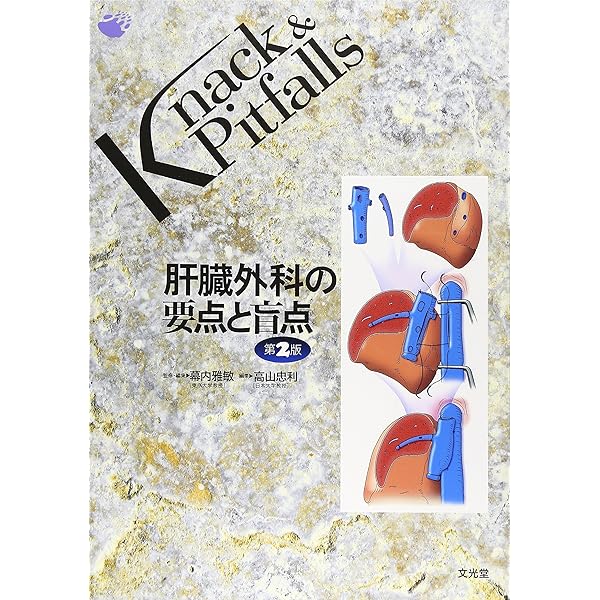 食道外科の要点と盲点 (Knack & pitfalls) | 幕内博康 |本 | 通販 | Amazon