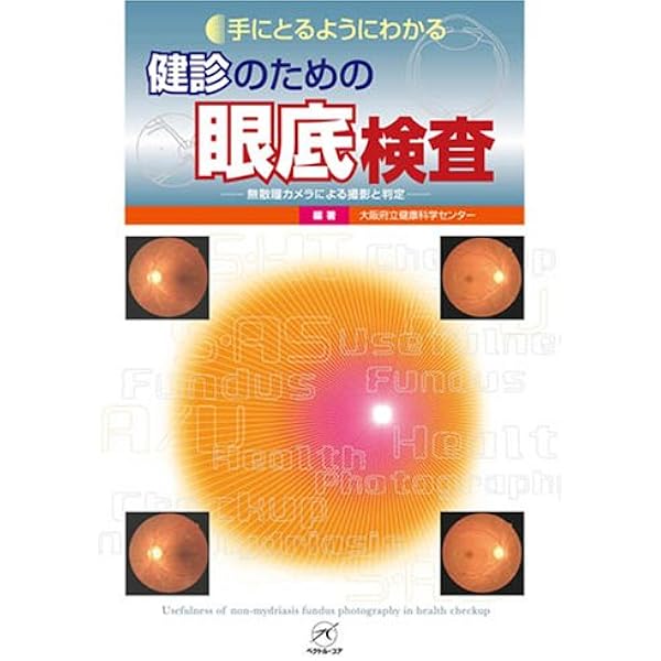 健診のための眼底検査 改訂版〜無散瞳カメラによる撮影と判定〜 (手に