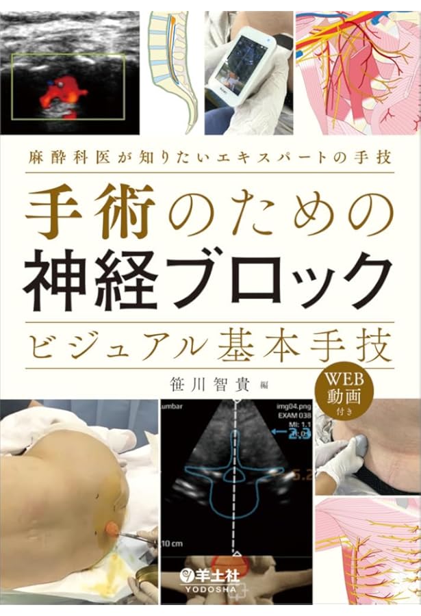 Amazon.co.jp: エレガントな全身麻酔のための区域麻酔法:その考え方と