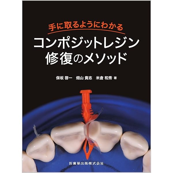 再根管治療を極める | 牛窪 敏博, 石井 宏, 尾上 正治, 尾上 由枝
