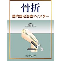 骨折 プレート治療マイスター−改訂第2版 | 澤口 毅 |本 | 通販 | Amazon