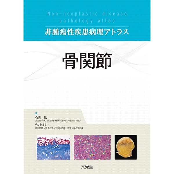 肝胆膵 (非腫瘍性疾患病理アトラス) | 原田 憲一, 能登原 憲司 |本