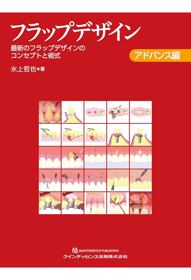 フラップデザイン ベーシック編: 4つの要素でわかる再生療法のための