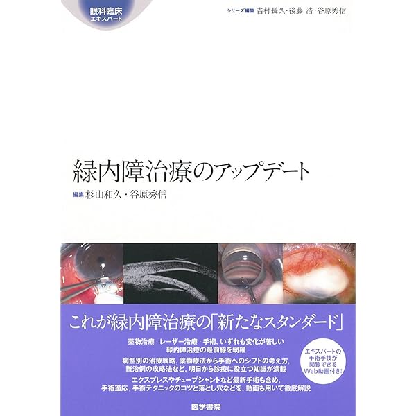Amazon.co.jp: All About 開放隅角緑内障 第2版 (眼科臨床エキスパート