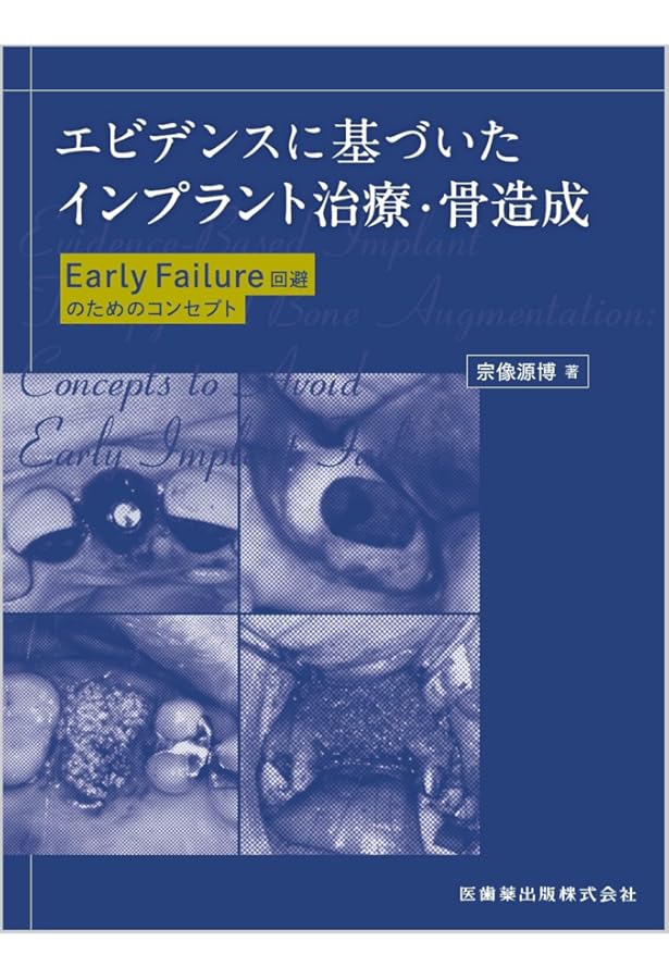 改訂版 インプラント外科: 動画で理解! 基本手技と自家骨移植の