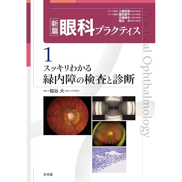 これさえ学べば死角なし!視野フロンティア (新篇眼科プラクティス 13