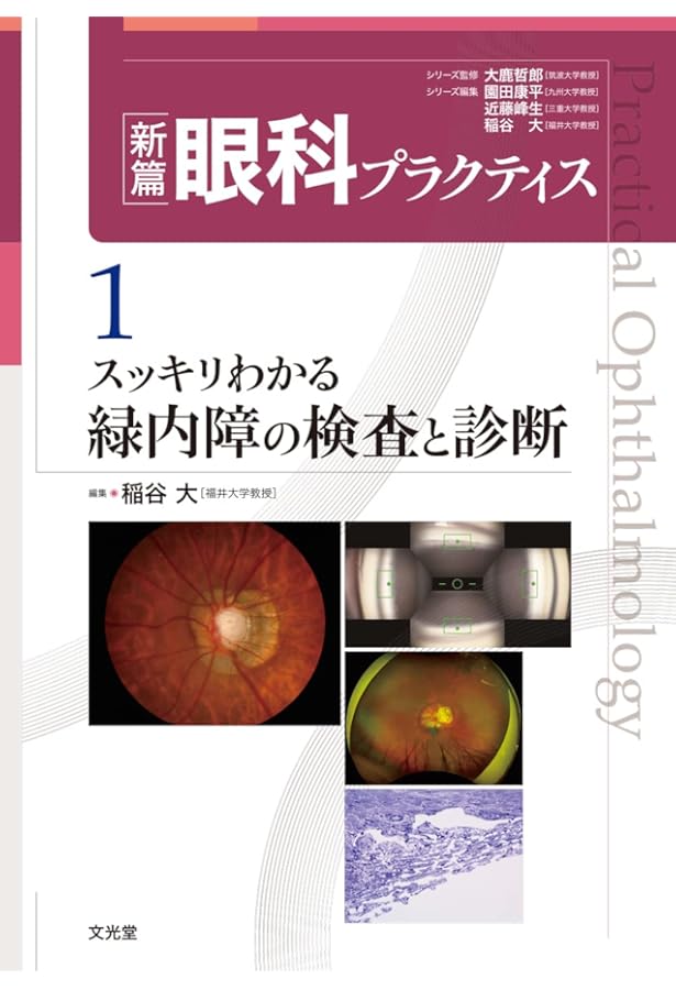 最新 眼科画像診断パワーアップ (眼科診療エクレール 2) | 辻川明孝