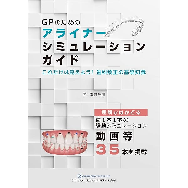 Amazon.co.jp: 図解! 矯正治療が面白いほどわかる本: 基礎知識