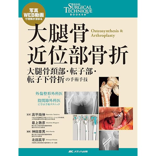 若手医師のための脊椎外傷の診断・保存的治療・手術: 写真・WEB動画で