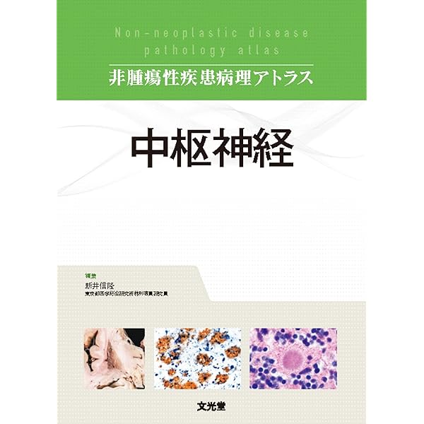 脳腫瘍 第2版(腫瘍病理鑑別診断アトラス) | 横尾 英明, 小森 隆司 |本