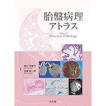 基礎と臨床の両側面からみた 胎盤学 | 日本胎盤学会 |本 | 通販 | Amazon
