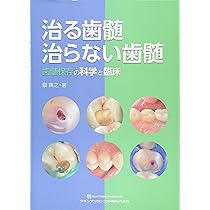 治る歯髄 治らない歯髄 | 泉 英之 |本 | 通販 | Amazon