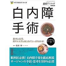 白内障手術: 基本と応用，術中トラブル＆リカバリーがわかる！ (眼科