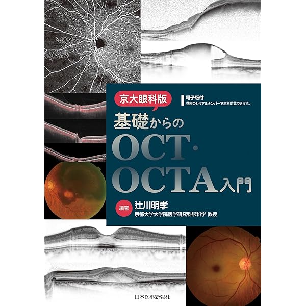 Amazon.co.jp: OCTアトラス 第2版 : 吉村 長久, 板谷 正紀, 辻川 明孝: 本