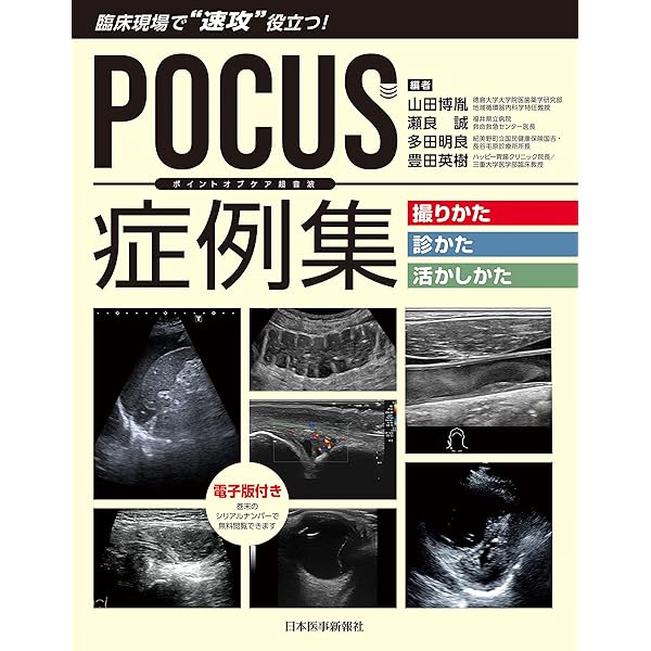 Point-of-Care超音波 原書第2版 ―電子書籍(日本語・英語版)付 | Nilam