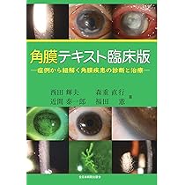 81gkN0KVCiL._AC_UL210_SR210,