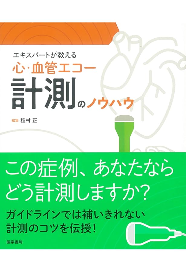 新・心エコーの読み方，考え方 改訂4版 | 羽田 勝征 |本 | 通販 | Amazon