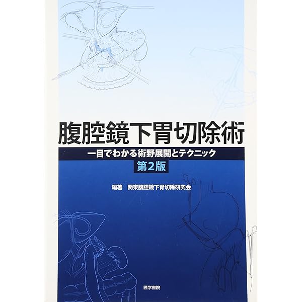 令和スタイル 鏡視下 胃手術のすべて | 比企 直樹, 布部 創也 |本