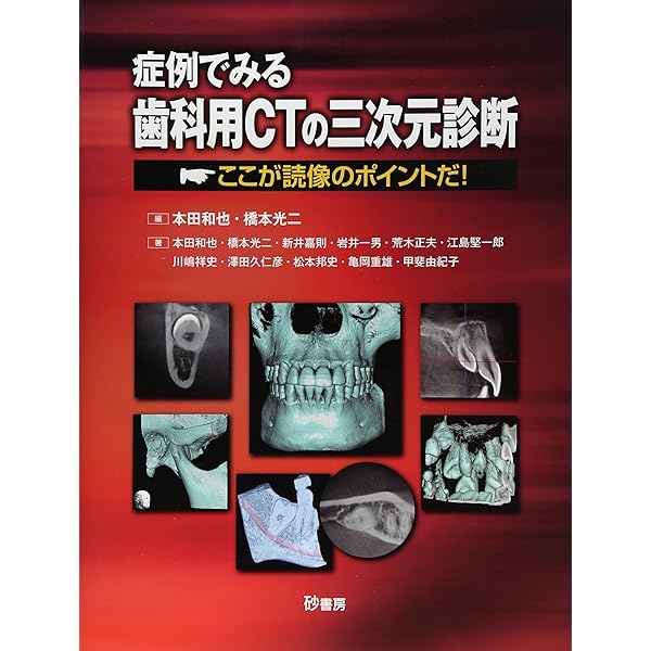 Amazon.co.jp: ATLASで学ぶ 歯科用コーンビームCT診断のポイント64