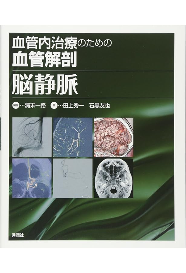 プライム脳神経外科3 脳・脊髄動静脈奇形と頭蓋内・脊髄硬膜動静脈瘻