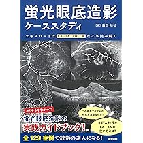 新OCT・OCTA読影トレーニング−改訂第2版 | 飯田 知弘, 森實 祐基