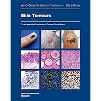 Breast Tumours: WHO Classification of Tumours (Medicine