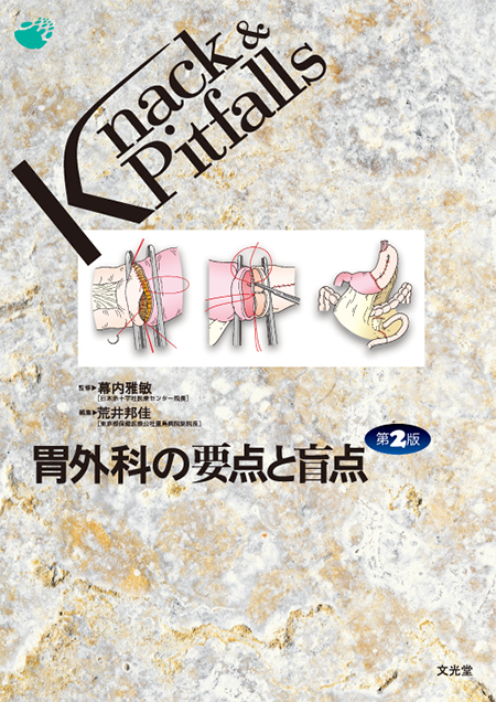 m3電子書籍 | Knack & Pitfalls 胃外科の要点と盲点 第2版