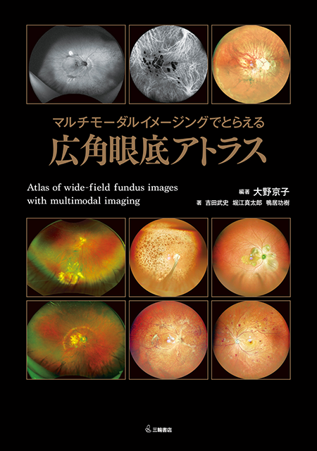 m3電子書籍 | 診断力がアップする！OCT・OCTAパーフェクト読影法