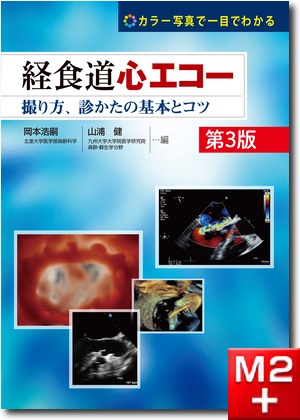 m3電子書籍 | TEE試験対策ガイド―JB-POT・心エコー図専門医試験徹底攻略