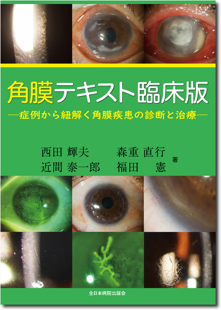 m3電子書籍 | 角膜テキスト臨床版―症例から紐解く角膜疾患の診断と治療―