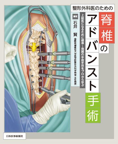 m3電子書籍 | 新OS NEXUS No.13 脊椎の再建法—すべり症から脊柱変形