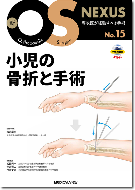 m3電子書籍 | 新OS NEXUS No.12 上肢の関節鏡視下手術［Web動画付］