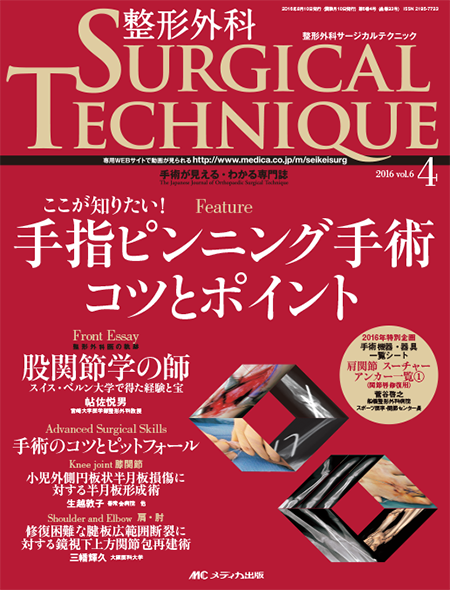 m3電子書籍 | 整形外科 Surgical Technique BOOKS11 肘の外傷［動画付き］