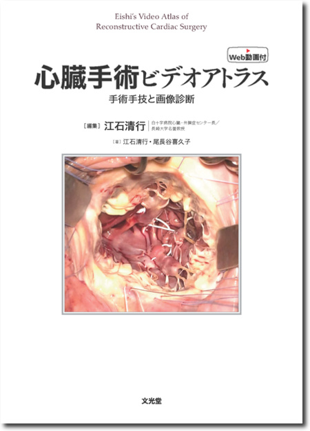 m3電子書籍 | 弁膜症の手術 ＜心臓血管外科手術エクセレンス②＞ [動画