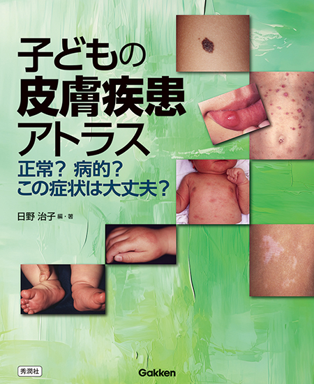 皮膚科学 第11版 皮膚科学／上野賢一／大塚藤男／藤本学 m3電子書籍