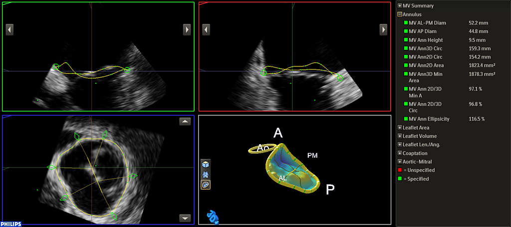 Ultrasound Workspace | Philips - Philips