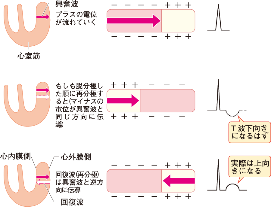 心電図波形の名称と成り立ち｜心電図とはなんだろう（2） | 看護roo