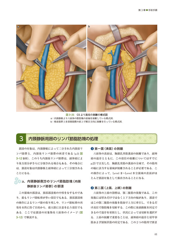 深頸筋膜の解剖学的構造から学ぶ 頸部郭清術 西嶌 渡(著) - 南山堂