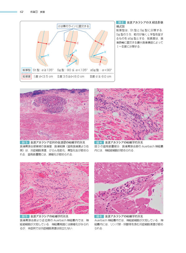 消化管 (非腫瘍性疾患病理アトラス) 九嶋 亮治(編) - 文光堂 | 版元