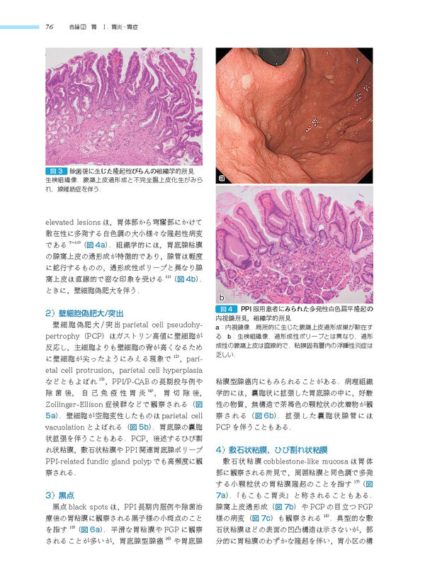 消化管 (非腫瘍性疾患病理アトラス) 九嶋 亮治(編) - 文光堂 | 版元