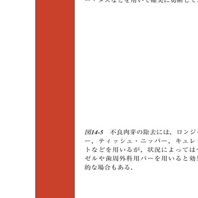コンセプトを持った予知性の高い歯周外科処置