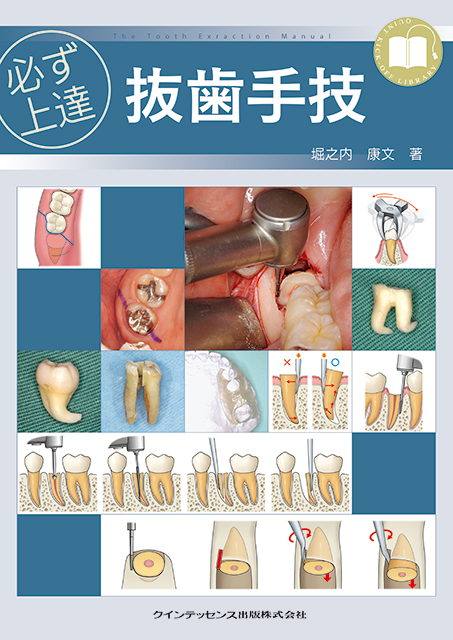 必ず上達 歯冠修復（下） - クインテッセンス出版