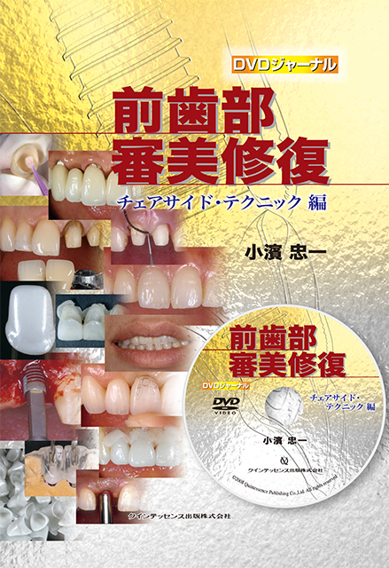 前歯部審美修復 インプラント編 - クインテッセンス出版