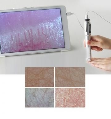 ビューティー（VIEWTY）マイクロスコープ | 業務用エステ用品・美容