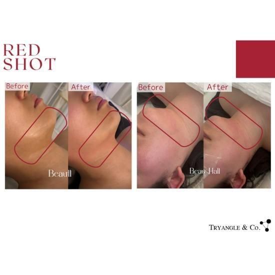 レッドショット 10ml×5本 - カタリヨオンラインストア